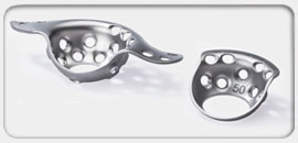 Reinforcement Cages Mueller & Burch-Schneider 