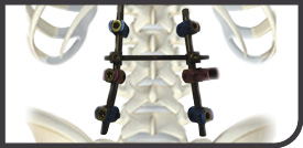 spine