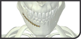 maxilofacial
