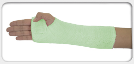 Soft Synthetic Cast 